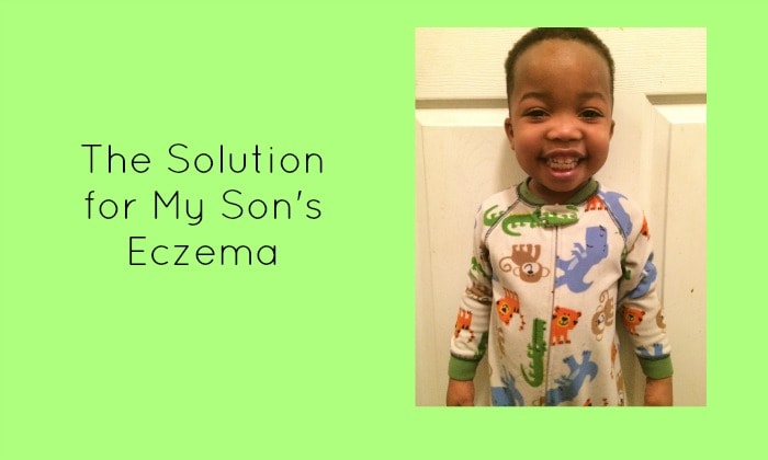 The Solution for My Son’s Eczema
